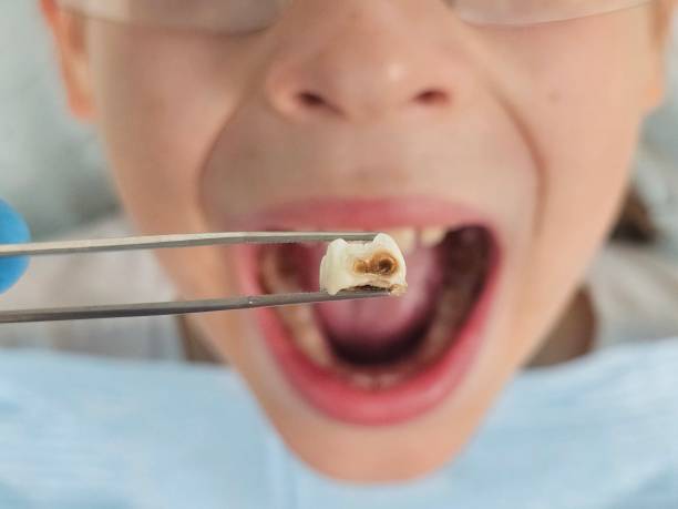 Best Urgent Dental Care for Toothache in Belcourt, ND